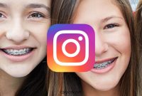 Nama Efek Filter IG Behel